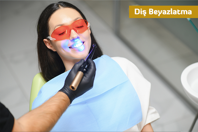 Diş Beyazlatma
