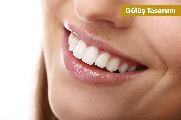 Gülüş Tasarımı