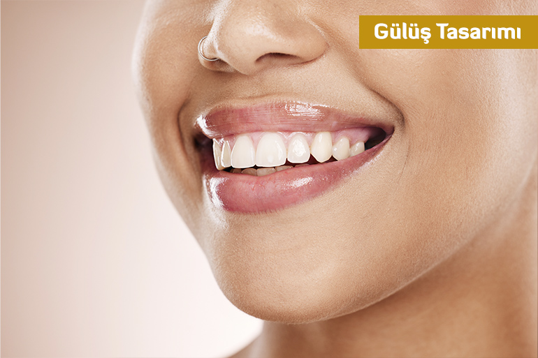 Gülüş Tasarımı