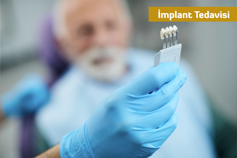 İmplant Tedavisi