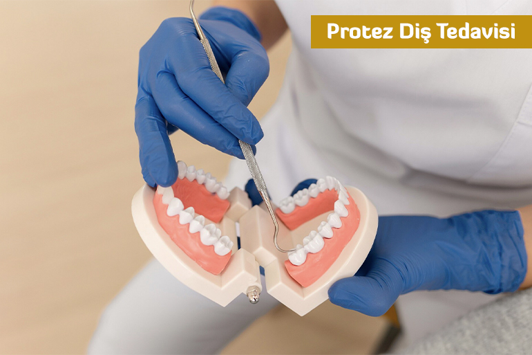 Protetik Diş Tedavisi