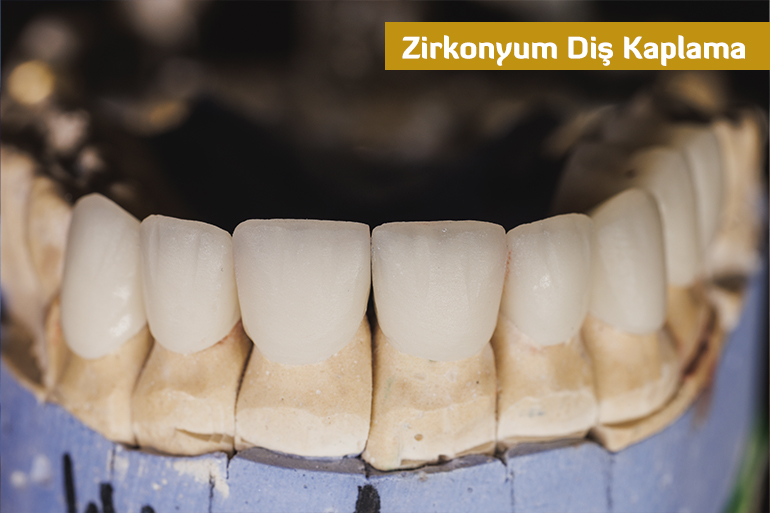 Zirkonyum Diş Kaplama