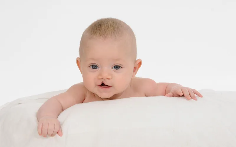 Dudak Damak Yarıkları - Prof. Dr. Hakan Ağır