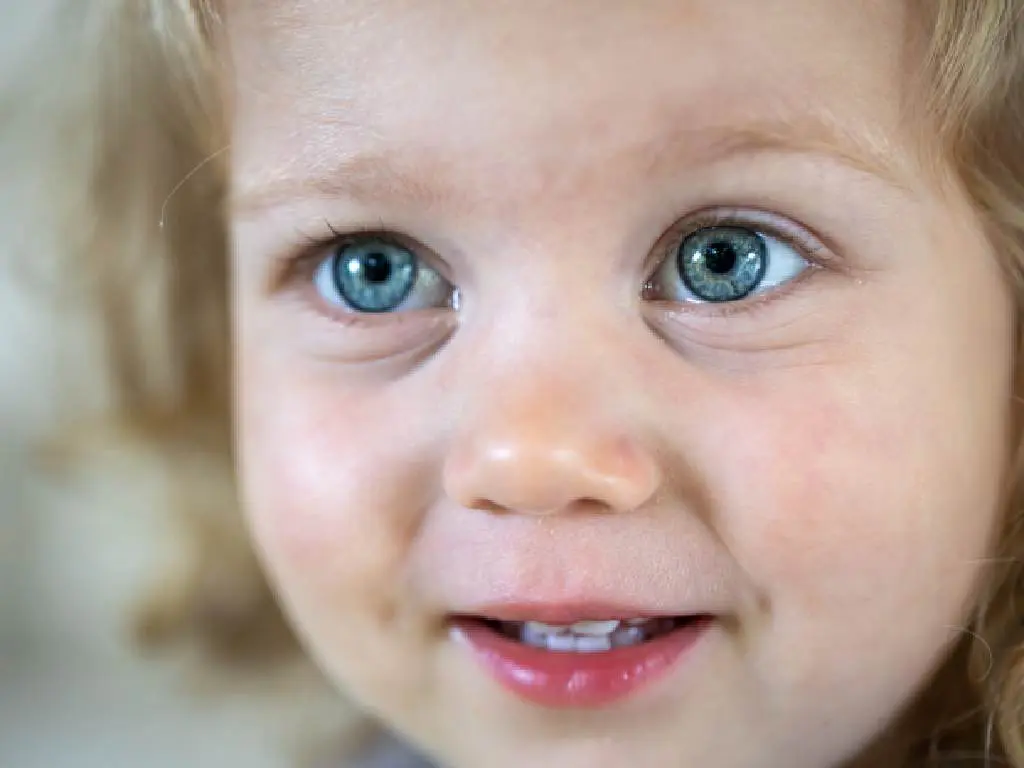 Dudak Damak Yarıkları - Prof. Dr. Hakan Ağır